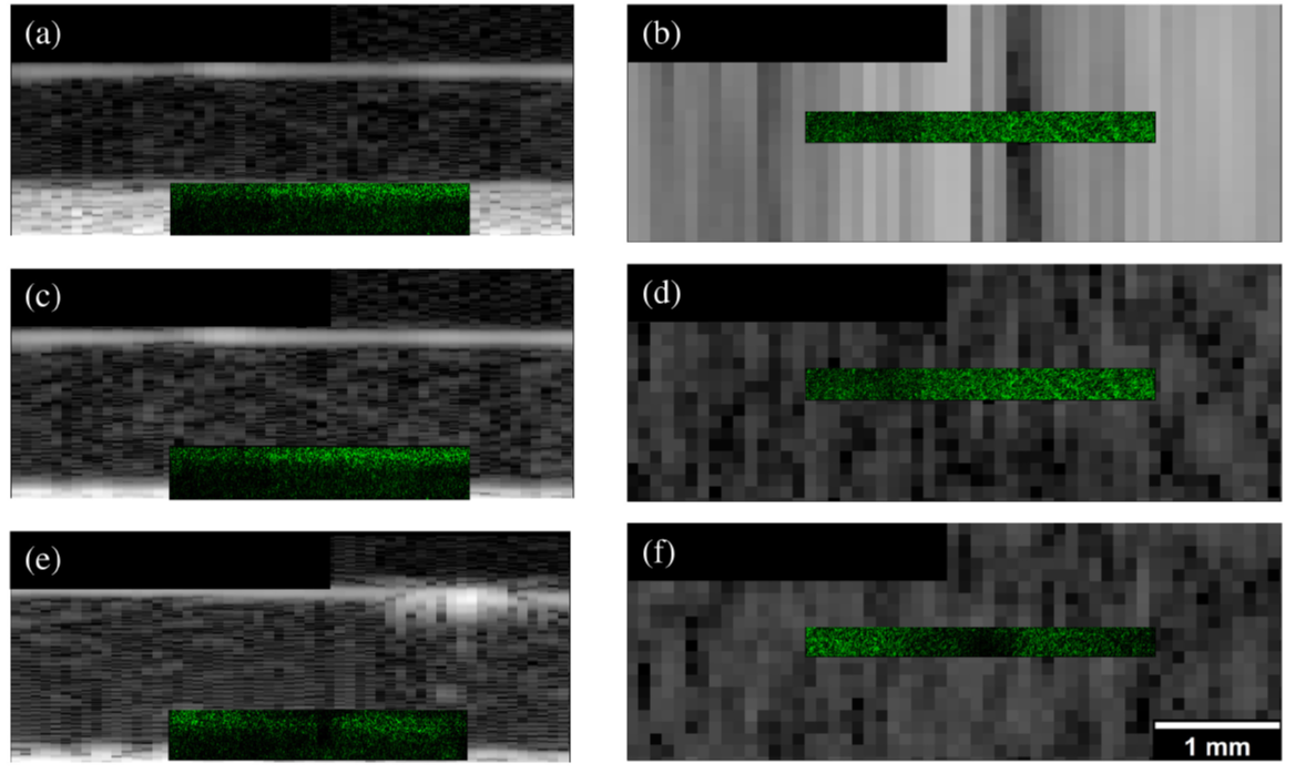 Registered slices of 3D B-mode data of a 2-mg∕mL collagen hydrogel with rayline scanning and various reception beamforming f ∕#s. The x –z slices are located 0.4 mm above the optical window. (a) and (b) Rayline scan slices on glass with an f ∕1 receive. (c) and (d) Rayline scan slices on glass with an f ∕2 receive. (e) and (f) Rayline scan slices on COC with an f ∕2 receive.